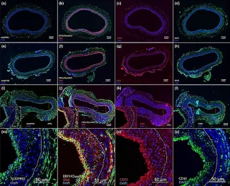 SPM receptor localization