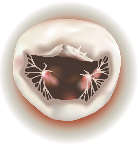 AML Repair1